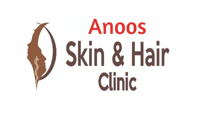 Skin And Hair Treatment Clinic in Guntur  : Anoos Skin and Hair Clinic in Brindavan Gardens