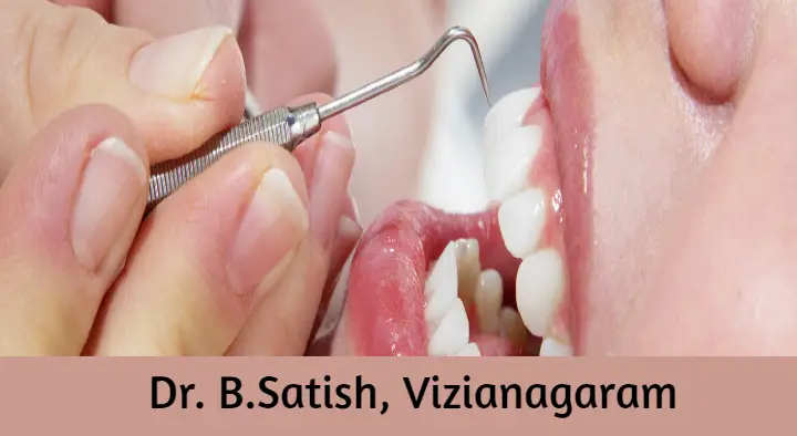 Doctors Dentist in Vizianagaram  : Dr. B.Satish in Balaji Nagar