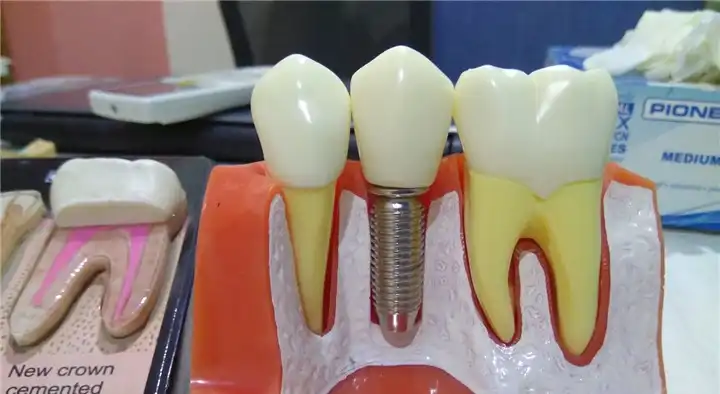 Your Dentist Dental Clinic in Ashok Nagar